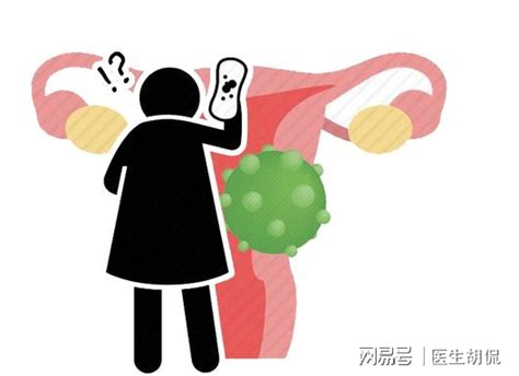 阴毛可以拔吗|女性私处毛毛太密，能刮掉吗？医生说出实话，看完再。